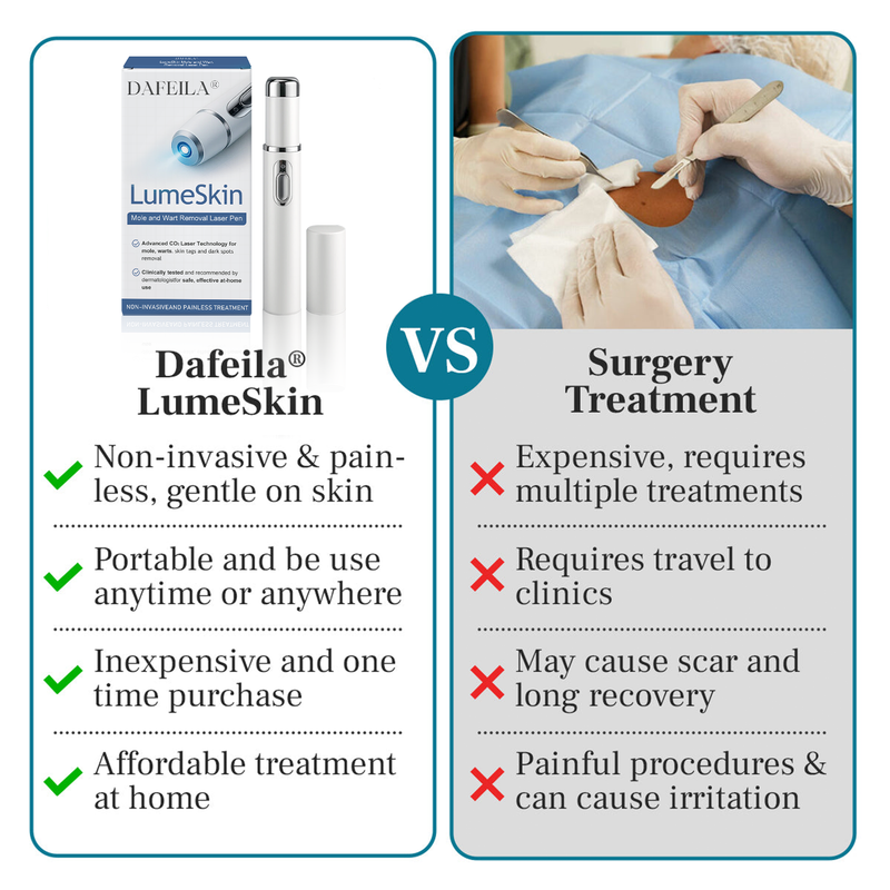 DAFEILA® LumeSkin Mole and Wart Removal Laser Pen 💙 8