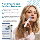 DAFEILA® LumeSkin Mole and Wart Removal Laser Pen 💙 8