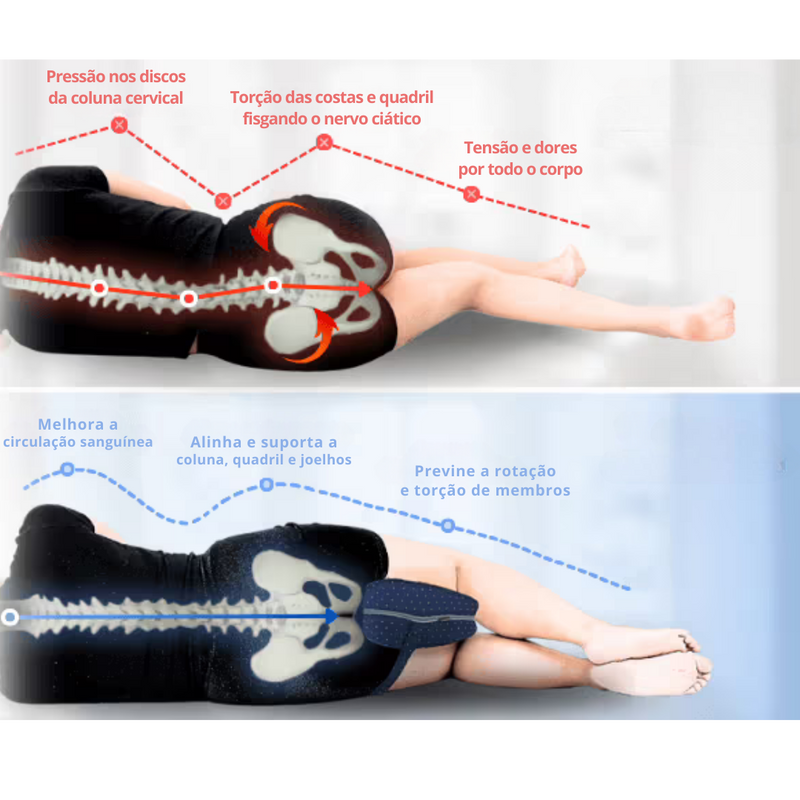Travesseiro Ortopédico SleepLeg Pro® | Alívio Imediato para Coluna e Pernas
