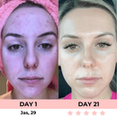 Lux Cove 7-in-1 LED Facial Sculptor