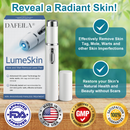 DAFEILA® LumeSkin Mole and Wart Removal Laser Pen 💙 8