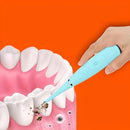 Removedor de Tártaro e Sujeiras - Dental