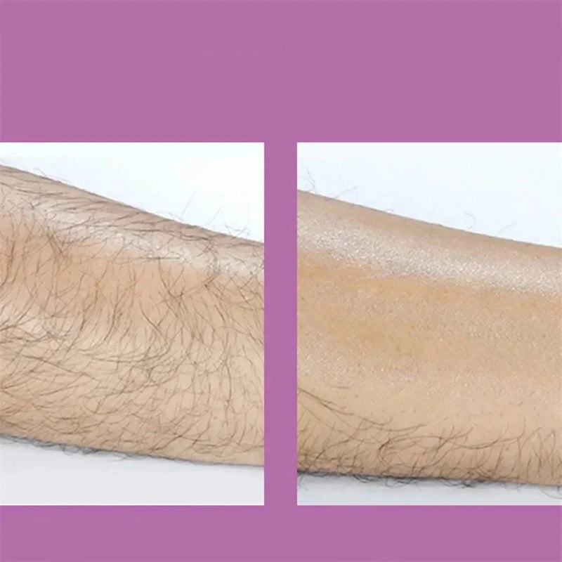 Women's Hair Removal
