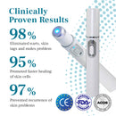 DAFEILA® LumeSkin Mole and Wart Removal Laser Pen 💙 8