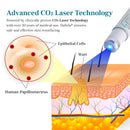 DAFEILA® LumeSkin Mole and Wart Removal Laser Pen 💙 8