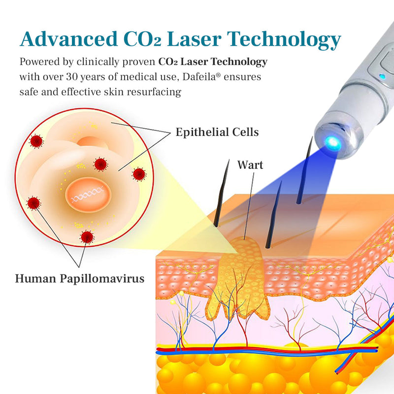 DAFEILA® LumeSkin Mole and Wart Removal Laser Pen 💙 8