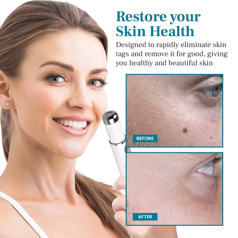 DAFEILA® LumeSkin Mole and Wart Removal Laser Pen 💙 8