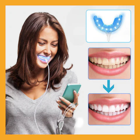 Professional Laser Teeth Whitening Kit