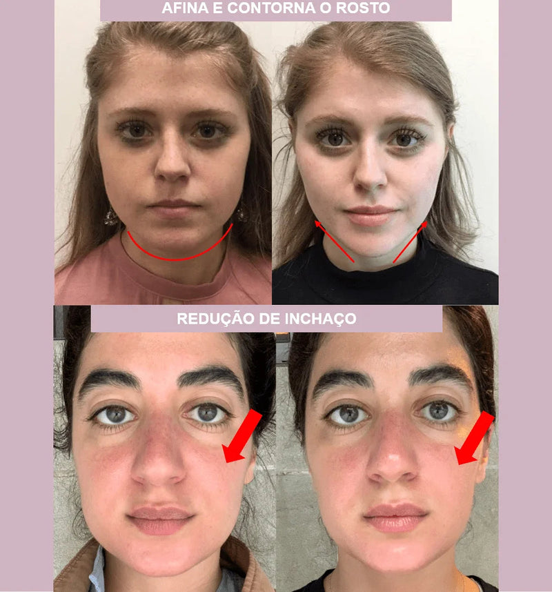 V-Revitalize™ - Facial Contouring Mask - Smoothes Wrinkles, Double Chins and Shapes the Face